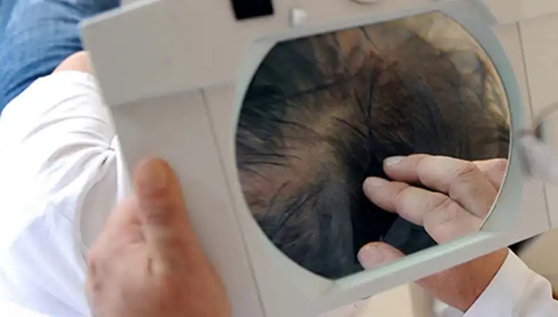 İstanbul'da Saç Ektirme İşlemi Sonrası Hayatını Kaybeden Genç Adamın Trajik Hikayesi