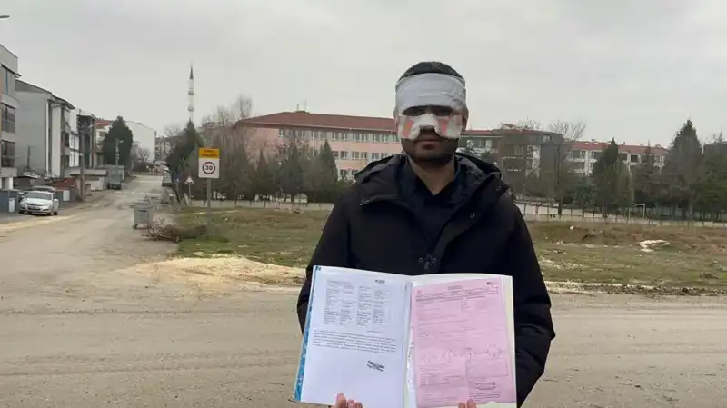 Öğretmen, Sınıfta Cani Bir İntikam Aldı: Yüzüne Sıcak Çay Fırlattı!