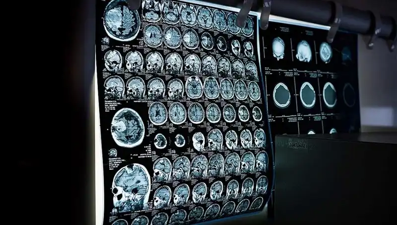 İstanbul'da Ücretsiz Kanser Taraması: 81 Bin Kişi Sağlık İçin Kontrol Edildi