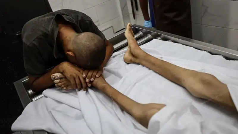 Gazze'de Korkunç Acı: Bir Çocuk Daha Açlıktan Hayatını Kaybetti