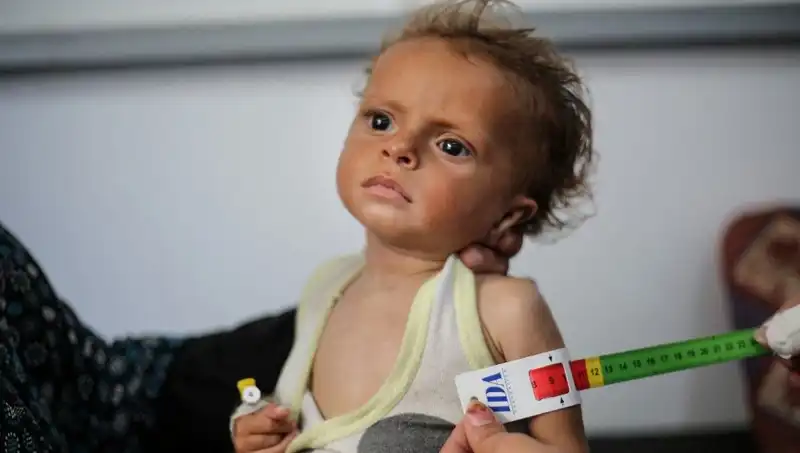 İngiltere, 300 Gazzeli Çocuğa Yeni Bir Gelecek Sunuyor